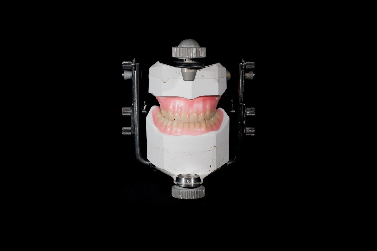 Prothèse complète montée sur un articulateur, au laboratoire