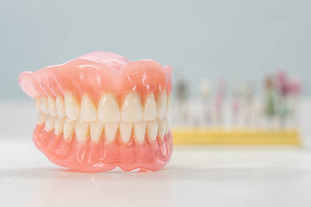 Prothèse dentaire réalisée au laboratoire